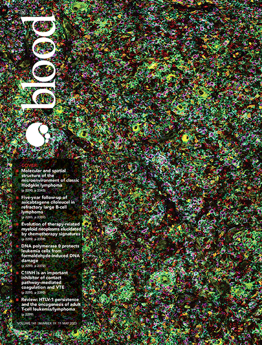 Our paper made the cover of @BloodJournal 

🔬Spatial and molecular profiling of the mononuclear phagocyte network in classic Hodgkin lymphoma🧬

Paper: ashpublications.org/blood/article-…

Commentary: ashpublications.org/blood/article/…