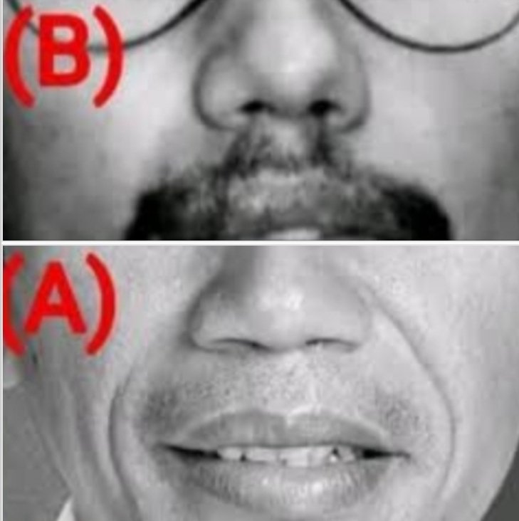 Ini adalah gambar yg paling bikin Cebong sekolam bergejolak, sawan, dan ngamuk2 ngga jelas, kalau muncul di timeline.

Padahal, 
Kan cuma  gambar dua orang, yang satu hidungnya mancung dan satunya lagi hidungnya pesek.
Trus mmg kenapa dg gambar ini sampai bikin Bong2 pada ngamuk?