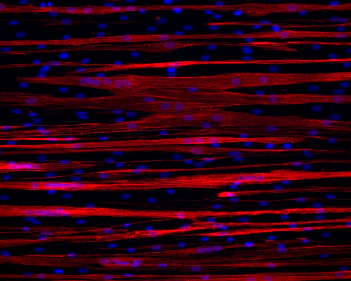 This weeks contribution to #FluorescenceFriday: 11 d old human primary myotubes stained for DAPI and alpha-actinin @HorwathOscar