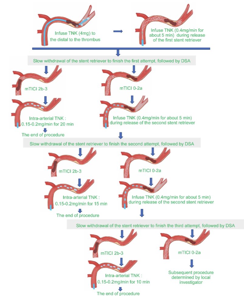 AshuPJadhav's tweet photo. Intra-arterial tenecteplase during thrombectomy for acute stroke (BRETIS-TNK II): rationale and design  https://t.co/DbfxJmcyJy https://t.co/fLJKBLP3Qu