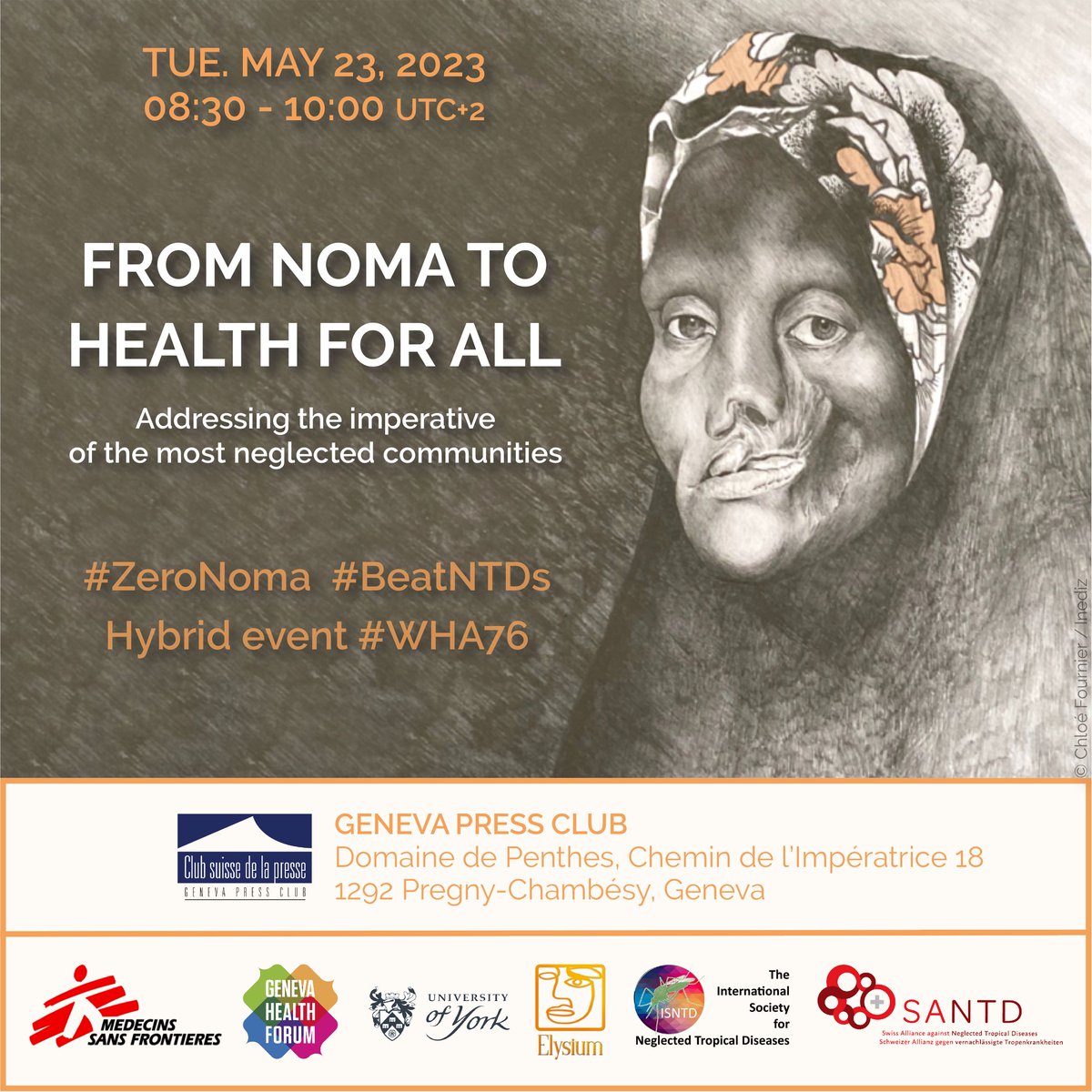 MSF International (@msf) on Twitter photo We want to give noma the attention it deserves! Join our #WHA76 event with noma survivors and <a href="/WHO/">World Health Organization (WHO)</a> speakers and let’s talk about the future of this preventable disease.
📆 Tuesday, 23 May
🕣 8:30-10:00 UTC+2
📍 Geneva Press Club and Zoom
👉 Registration- docs.google.com/forms/d/e/1FAI… We want to give noma the attention it deserves! Join our #WHA76 event with noma survivors and <a href="/WHO/">World Health Organization (WHO)</a> speakers and let’s talk about the future of this preventable disease.
📆 Tuesday, 23 May
🕣 8:30-10:00 UTC+2
📍 Geneva Press Club and Zoom
👉 Registration- docs.google.com/forms/d/e/1FAI…