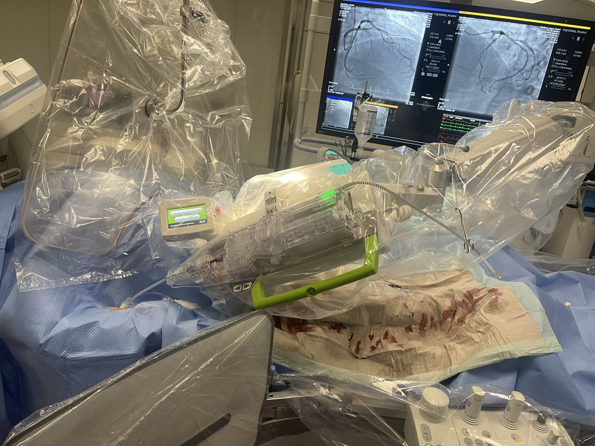 vlacho13's tweet photo. Is orbital atherectomy feasible with #Corindus Corpath GRX? Here is our experience in @Klinikumlippe . Performed with @MohammadAlMawe3 https://t.co/KfLHnzZh8q