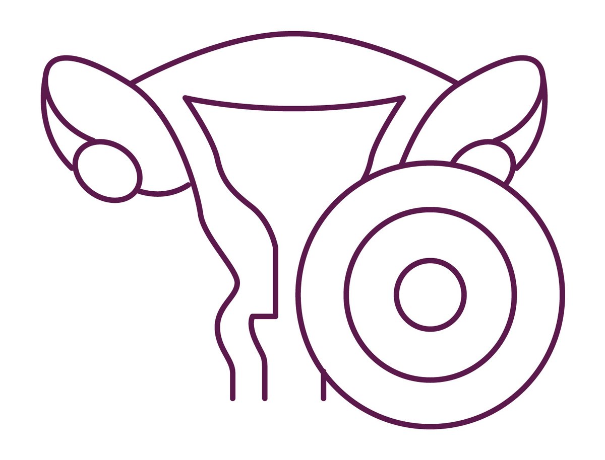 CrcdcHdf's tweet photo. [#cancercoluterus] A qui m'adresser pour réaliser le test de dépistage ? Qui est concerné par la vaccination contre les HPV ? 🧐
Vous trouverez toutes les informations ici ➡ https://t.co/odTBINVPVl
#dépistage #cancer #Prévention #preventioncancer #CrcdcHdF https://t.co/GaxuN6K6Ej
