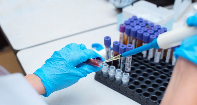 Dt_Aerzteblatt's tweet image. Biomarkertest bei Brustkrebs: G-BA überprüft neue Studienlage:  Berlin – Mit Biomarkertests lässt sich das individuelle Rückfallrisiko bei einer Brustkrebserkrankung bestimmen. Ob das auch bei Betroffenen mit primärem… #Biomarkertest #Brustkrebs #GBA  dlvr.it/Snx9vQ