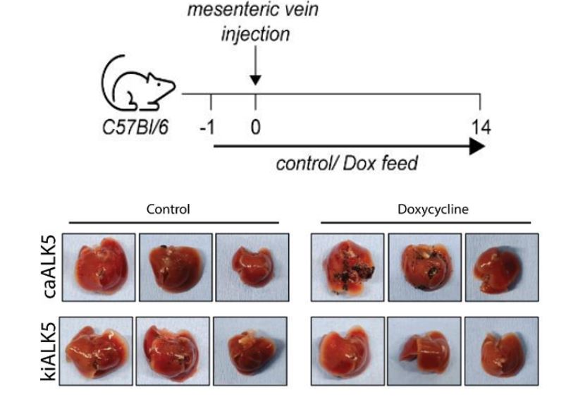 📃Our paper is out on how activation of #TGF-beta receptor signaling promotes #melanoma metastatic outgrowth in liver: lnkd.in/ertgPDm9