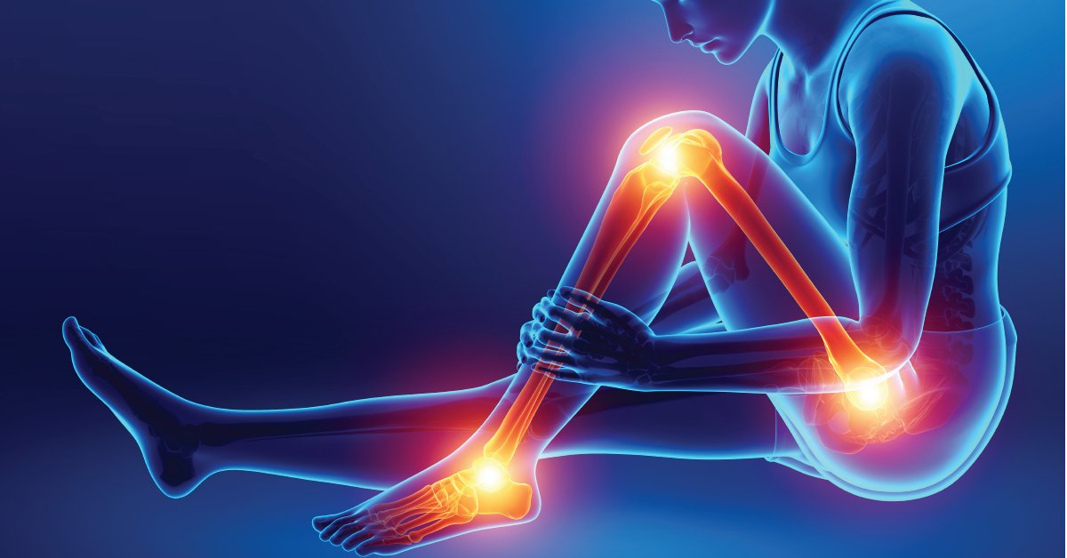 Your bones need to be strong and healthy. But some things aren’t so good for them. Here's how to know if your bone health is at risk: wb.md/3peVkvx