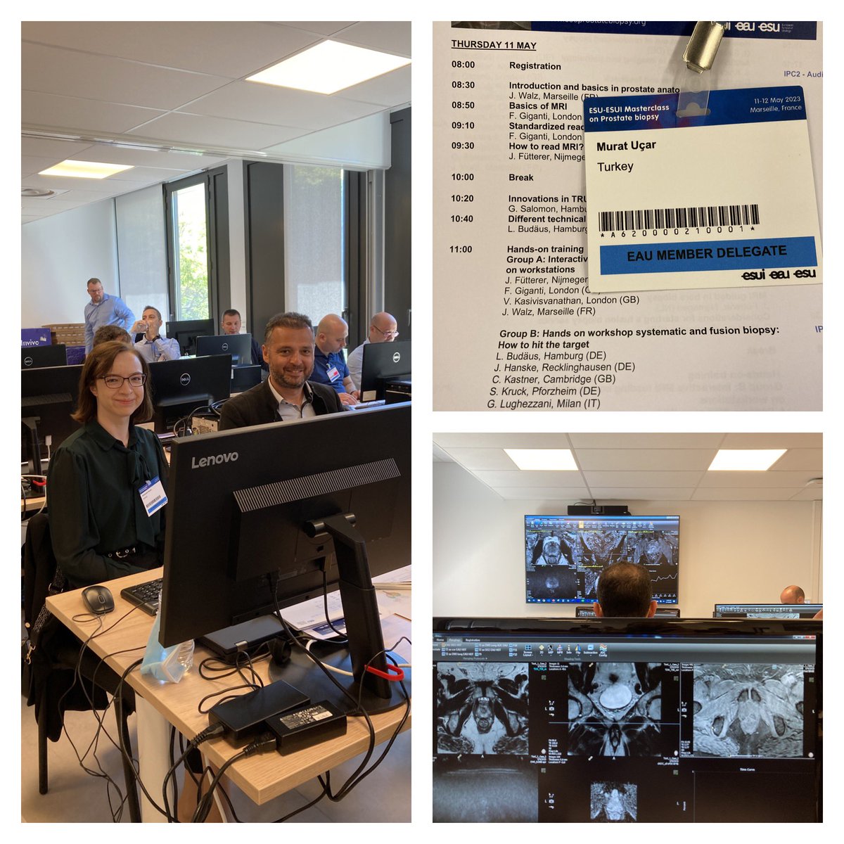 dr_muratucar's tweet photo. Prostate biopsy masterclass #prostate #prostatecancer #prostatebiopsy #MRI #fusionbiopsy #multiparametricMRI #focaltherapy #eau #esu #esui #esut #uroweb #masterclass https://t.co/QfAvEVUpnN