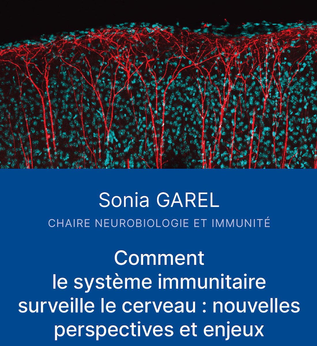 GDR microglia&neuroinflammation (@sophielaye) on Twitter photo 