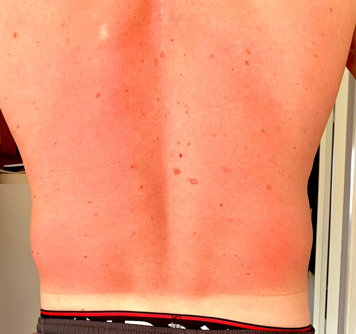 Spartanen83's tweet photo. Jaha, det hΓ€r kommer bedΓΆmt kΓ€nnas imorgon. π€·πΌββοΈ #quickburn https://t.co/inAzEbWI39