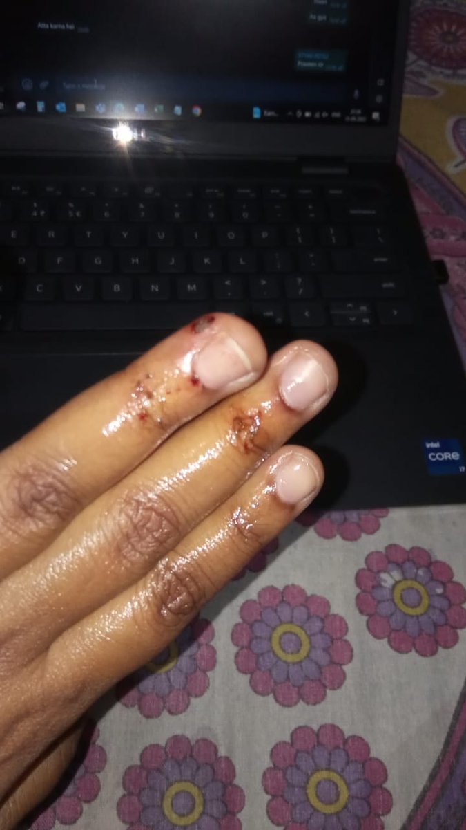 samar_kaurS's tweet photo. .@Uppolice @uptrafficpolice Please read out the summary attached and tell me how do I help myself now?
Will you be able to serve any justice. 
to the readers, #Beware of #woman #driver 
there is no humility or acceptance left in 2 legged animals roaming in the planet. https://t.co/DAypuBvFdI