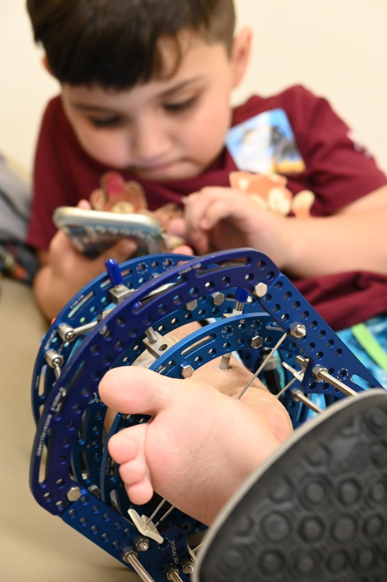 dotbat's tweet photo. ShrinersStLouis: Sante's family traveled from their home in Honduras for care with the Center for Advanced Pediatric Limb Reconstruction &amp; Lengthening at Shriners Children's St. Louis. He's currently undergoing lengthening with an external fixator. 

Mor… https://t.co/gkArHvZmob
