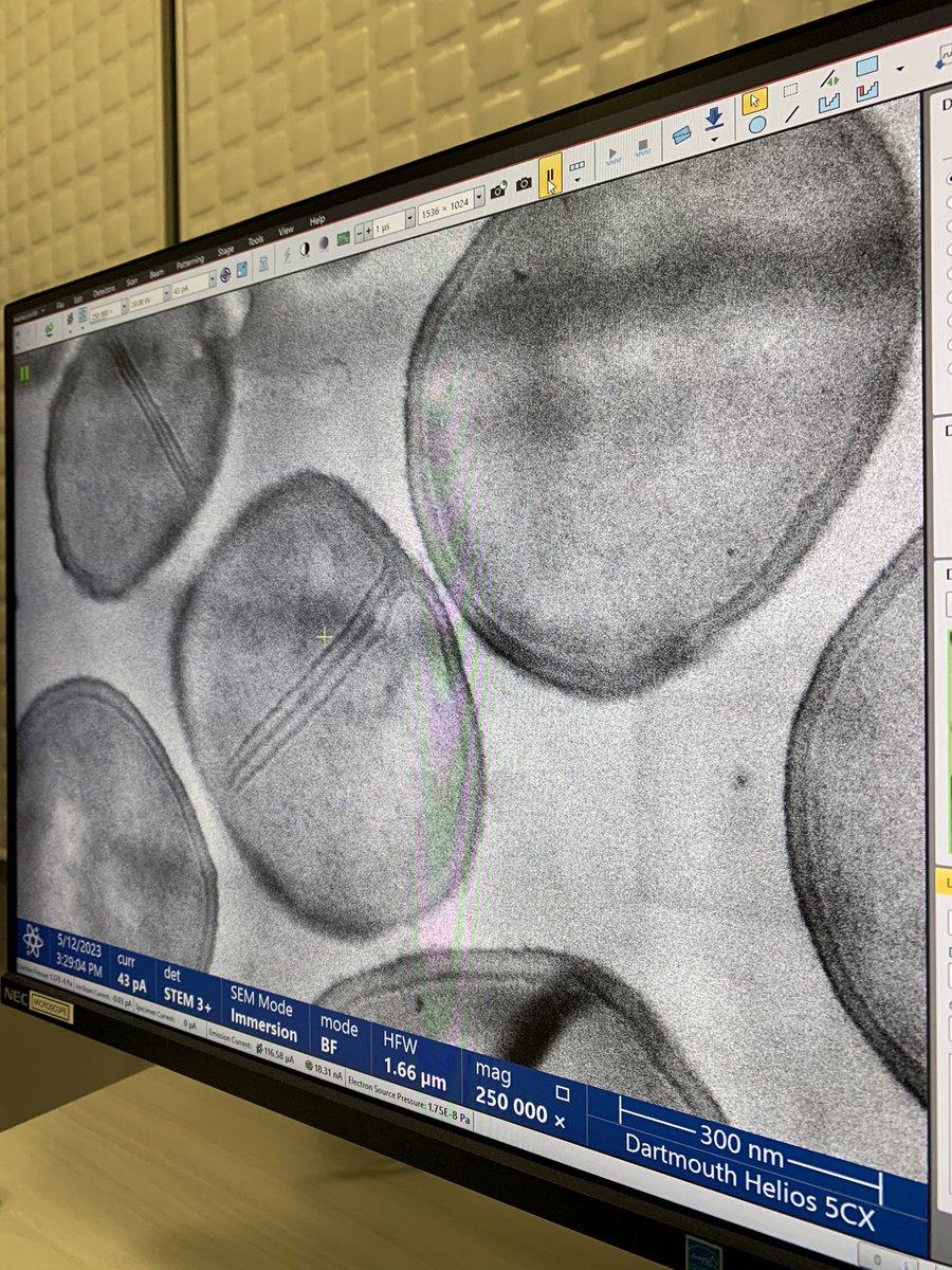 FabriceJPierre's tweet image. Spending my afternoon looking at electron microscopy images. Science is amazing! Anyone knows which bug I’m looking at? 🦠#polymicrobial #electronmicroscopy #science