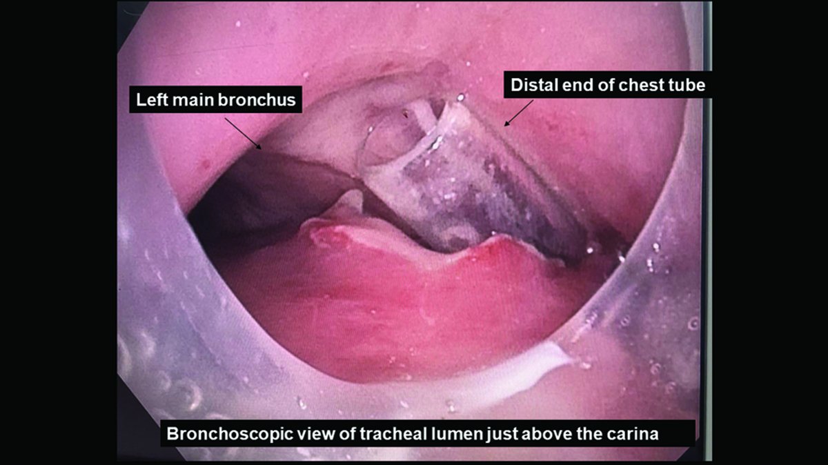 Anesthesiology Journals tweet media