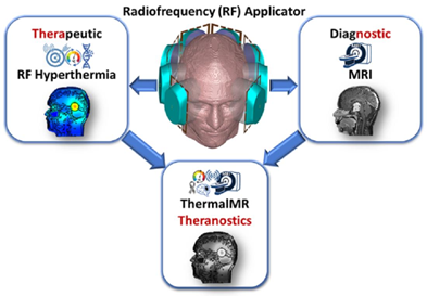 Cancers_MDPI's tweet photo. 🔎This #article advances integrated radiofrequency (RF) applicators for Thermal Magnetic Resonance (ThermalMR) theranostics that facilitate diagnostic MRI and targeted thermal therapy of brain tumors✔️

📖Enjoy reading more here: https://t.co/9khJgqZMKf

👏by Nandita Saha et al. https://t.co/KHTFZGMJUY