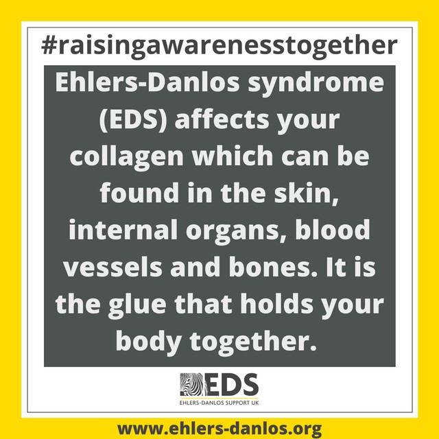 May is Ehlers-Danlos Syndromes and Hypermobility Spectrum Disorders Awareness Month! The Ehlers-Danlos syndromes (#EDS) are a group of thirteen individual genetic conditions, all of which affect the body’s connective tissue. ehlers-danlos.org/what-is-eds/ #EhlersDanlosSyndrome