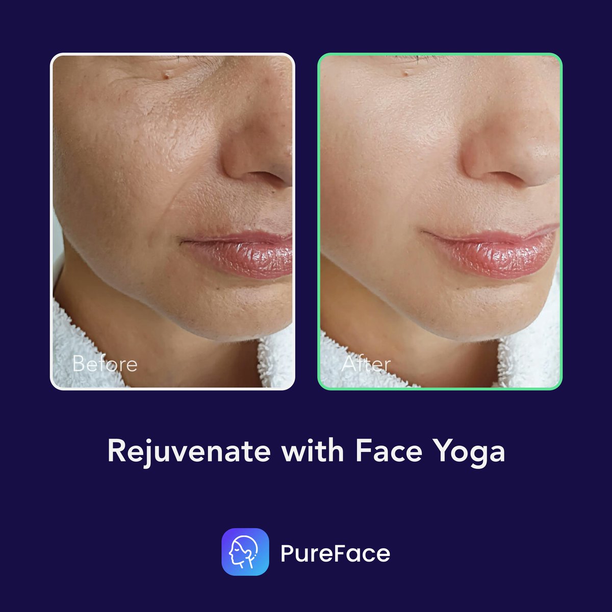 purefaceapp's tweet image. "Real results with PureFace's face yoga program! 💥

Check out these incredible before and after photos.

Begin your transformation now! 🦋 #PureFaceRealResults

#faceyoga #pureface #beforeandafter #skincare #wellness #realresults #instabeauty #successstories #selfcare #glowup