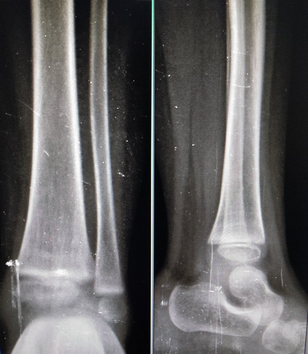 Orthopod tweet media