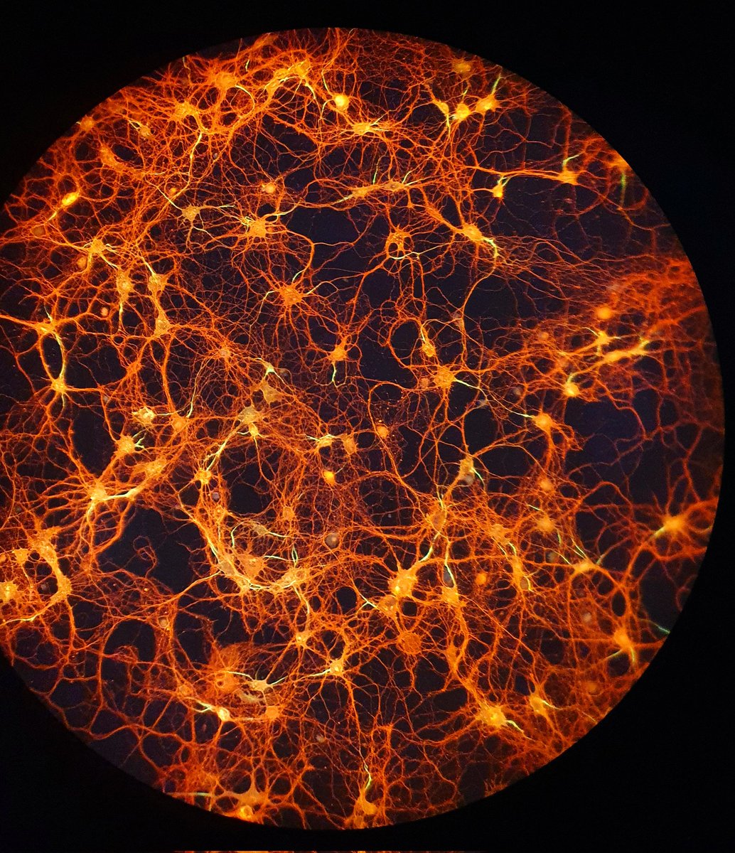 How many neurons do we have here!? A very dense neuronal culture for #MicroscopyMonday