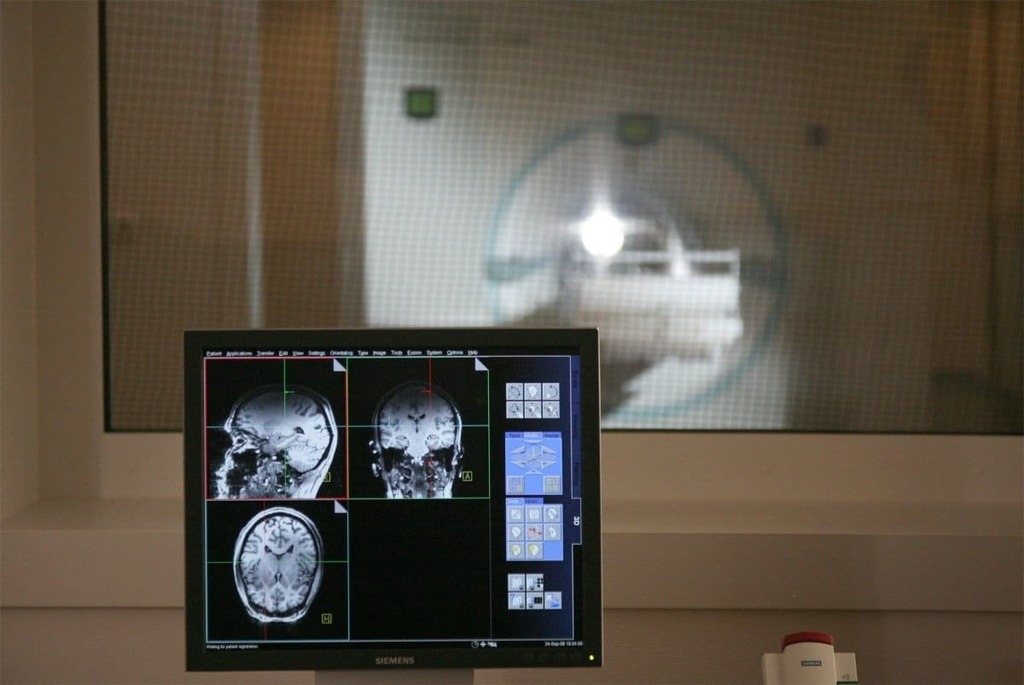SelfdrivingC's tweet photo. @gerald_bader : RT @enilev: Revolutionary #MRI #Imaging Technique Reveals #Brain Glucose Metabolism #Without #Radiation Exposure
@MedUni_Wien 
#Neuroscience #HealthTech #MRI #AD #Cancer 
👉https://t.co/GKTZoNk46J

@gerald_bader @IanLJones98 @bimedotco… https://t.co/toyd17slbV) https://t.co/5N9zw0nWON