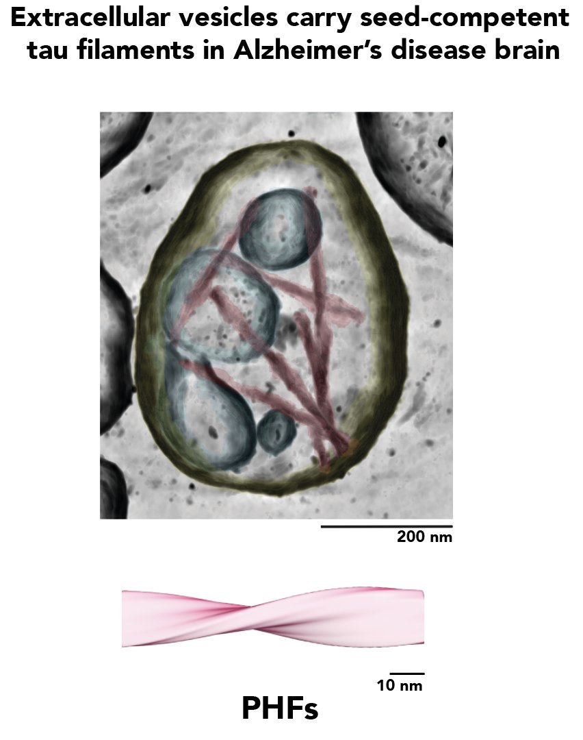 So excited to announce our preprint describing tau in extracellular vesicles from Alzheimer's disease brain tissue! A thread... ➡️ @Duff_Lab @bwfalcon

doi.org/10.1101/2023.0…                             

#neuroscience #brain #science #extracellularvesicles #CryoEM #teamtomo