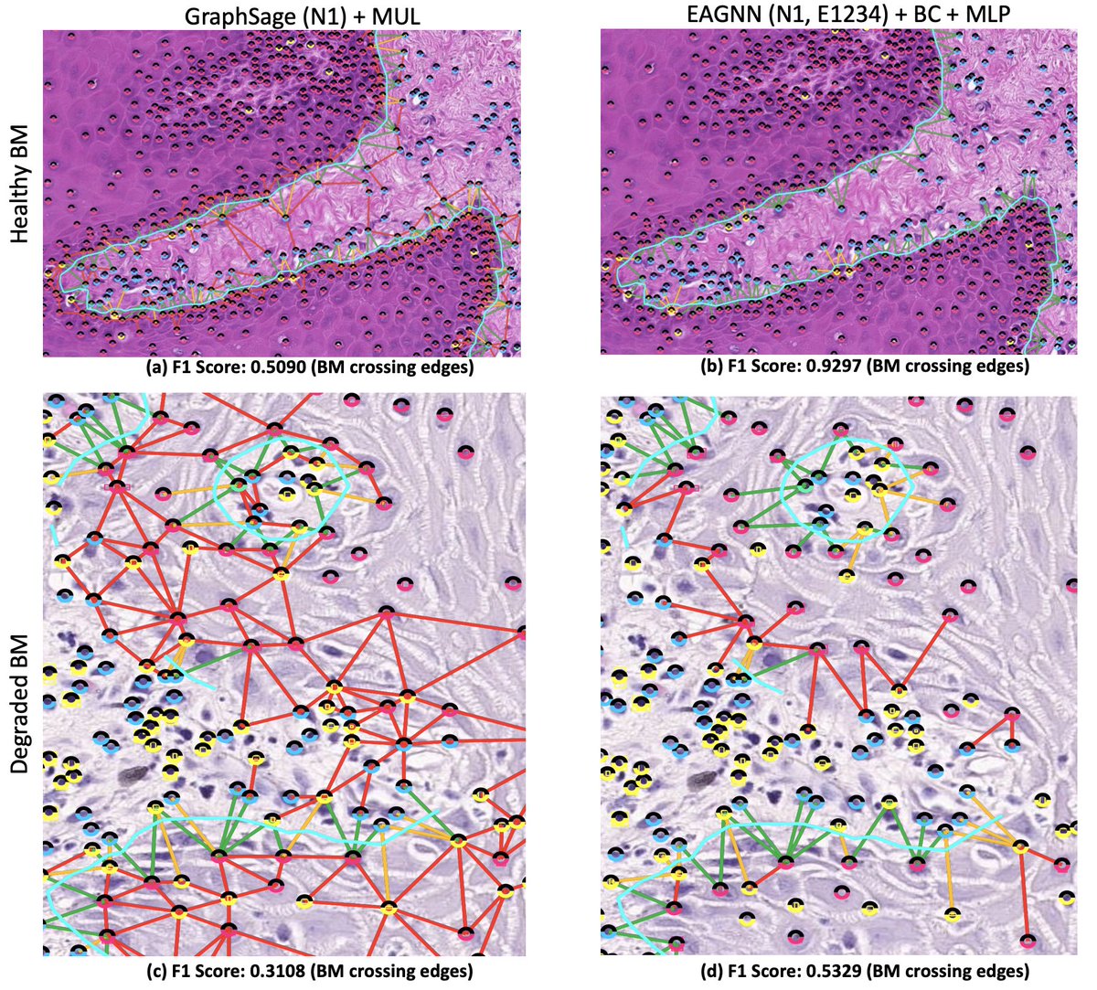 a_a_nair's tweet photo. Super excited to present our recent work at #IPMI2023! We propose EAGNN (Edge Aggregated GNN), which aggregates node and edge features to take advantage of the tissue topology and facilitate edge label prediction for medical images. 
@Karl_Meinke @RachaelVSugars  @ipmi2023 
#GNN https://t.co/7Oazz6z7h0