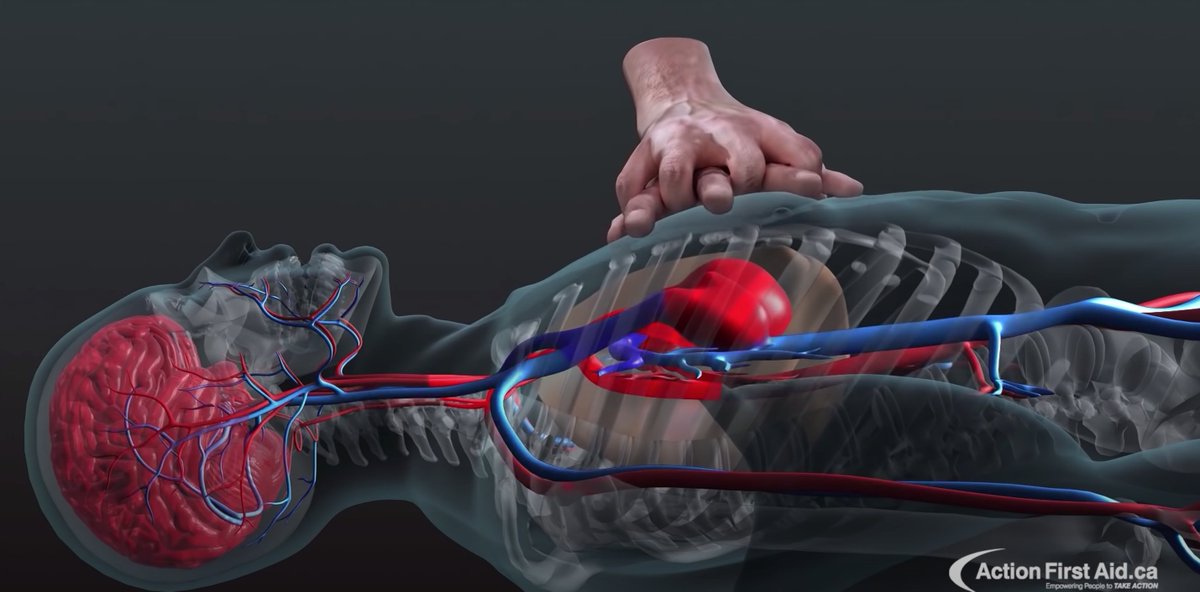 WELMedical's tweet image. This 3D video of CPR in action provides an inside look at the impact each chest compression has on the body during a cardiac arrest emergency.

Watch it here: youtu.be/DUaxt8OlT3o?ut…

#CPR #3DCPR #CPRAwareness