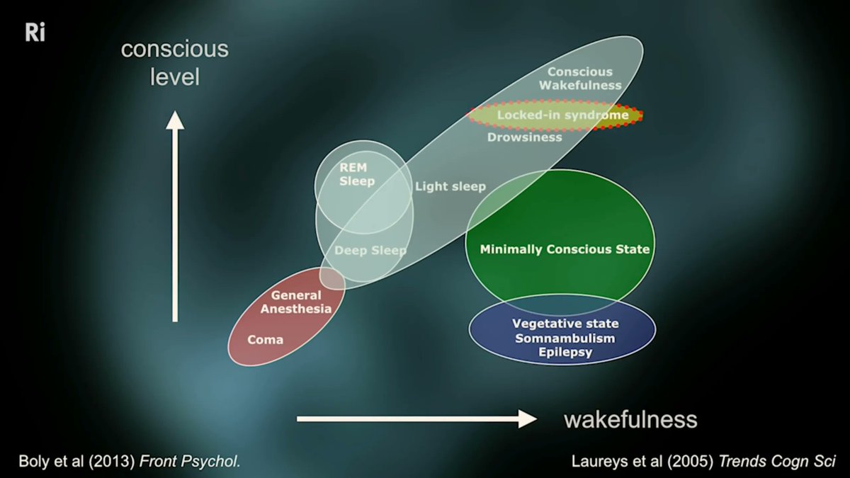 fritzemedia's tweet photo. Very cool study on what it means to be alive by Dr Melanie Boly at U of Wisconsin-Madison along with others. Many amazing studies available on https://t.co/RcaBngKZE0 https://t.co/HuIxdjcxZI