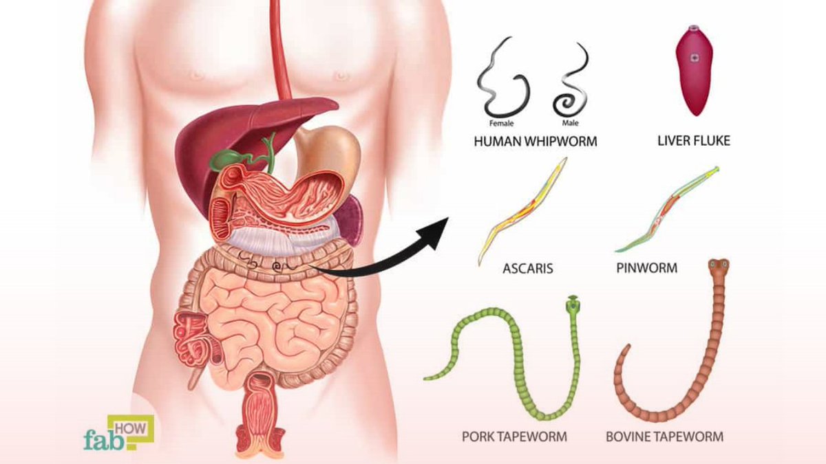 The Secret to Relieving Constipation (It's Not What You Think...) 🧵⤵️