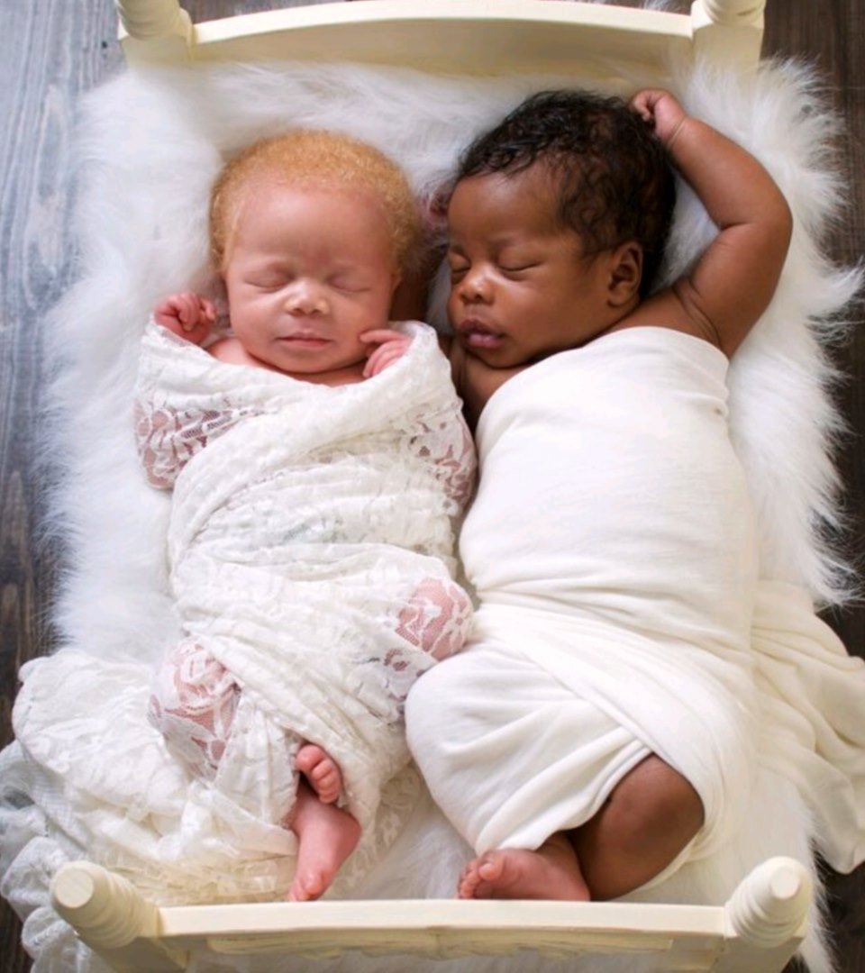 “The first time I saw her, I wondered if the nurse was handing me my baby, or someone else’s. I waited a few seconds for someone to tell me there was a mix up. How did I get black and white twins?”

Read more 
theepochtimes.com/photographer-g…