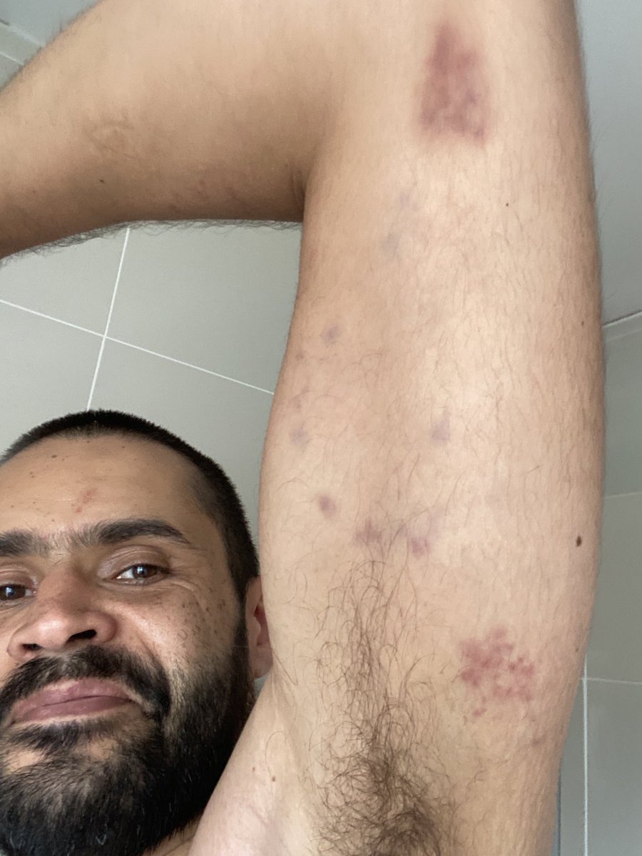 madplatt's tweet image. Go to open mat on a bank holiday, they said.
It will be fun, they said 😅

#bjj #openmat