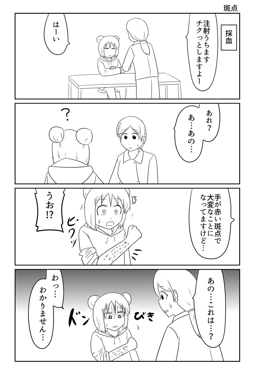 斑点 