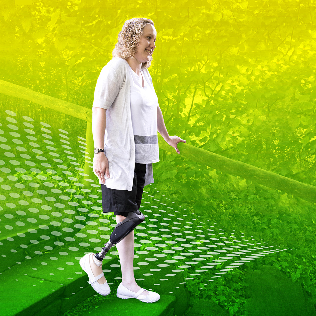 BlatchfordUS's tweet photo. Limb loss and the resulting necessity to adapt to an artificial substitute inevitably bring about a significant alteration in the amputee’s abilities, activities, lifestyle, and often, attitude. https://t.co/yEsNpxVmOn
#Orion3 #LLLDAM https://t.co/K4MwfkY5WF