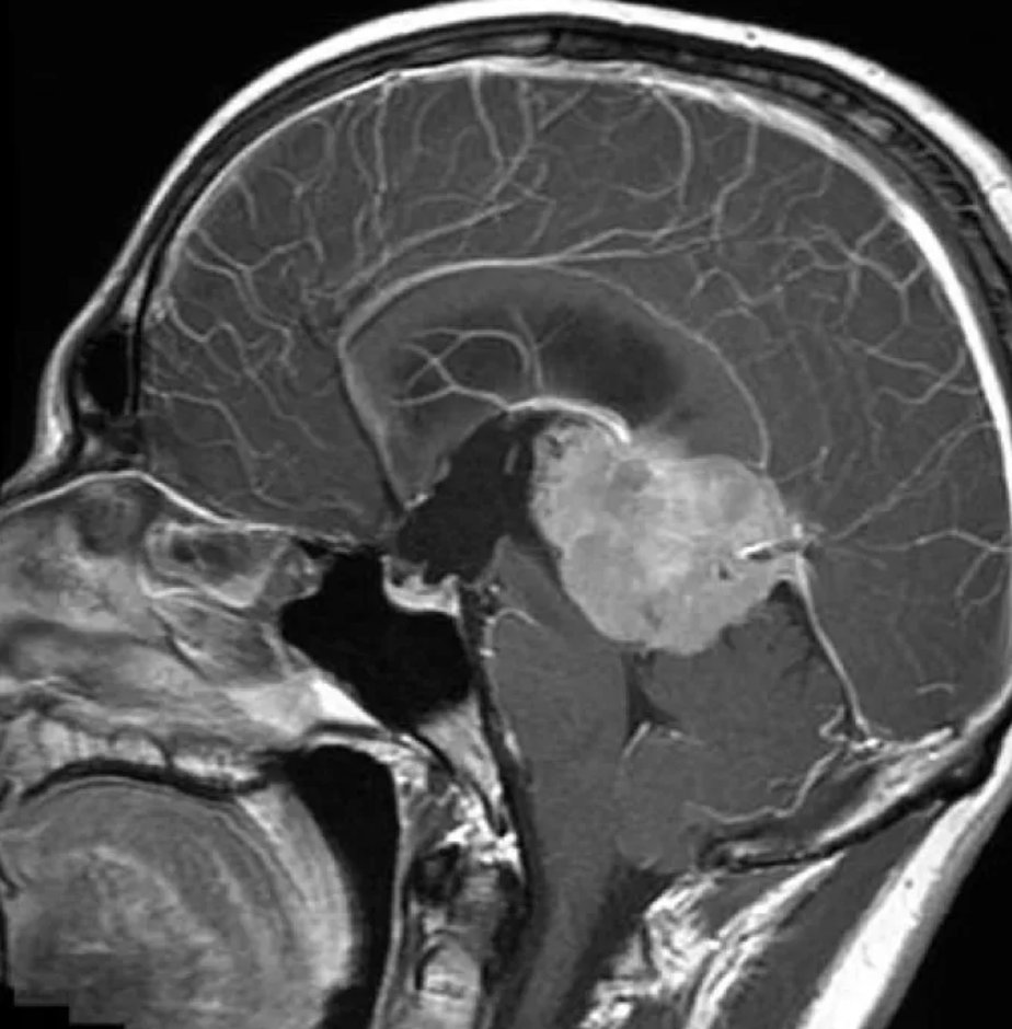 radRounds Radiology Network tweet media