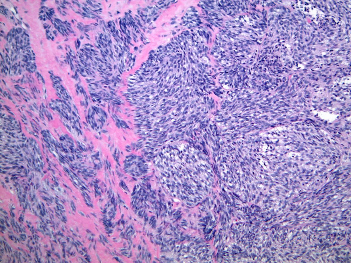 Scott Kilpatrick, MD tweet media