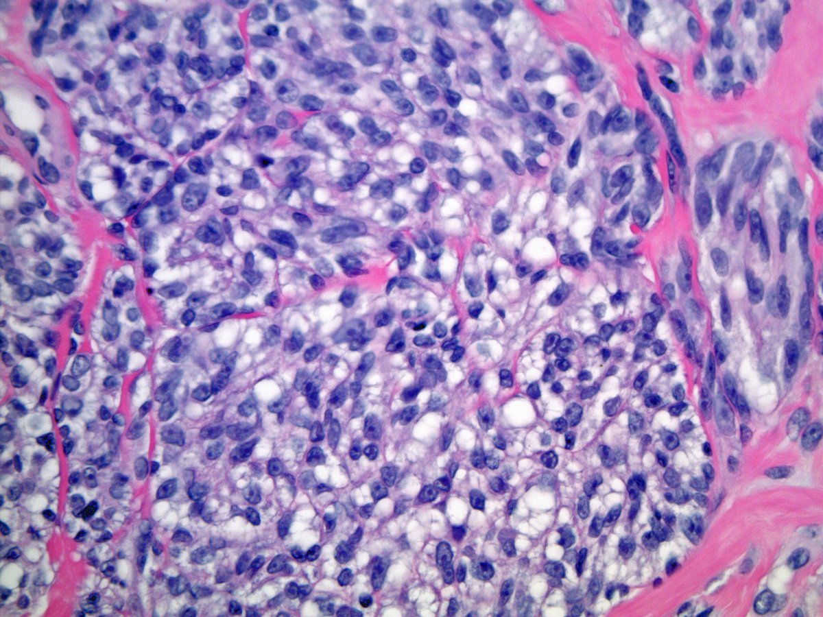 Scott Kilpatrick, MD tweet media