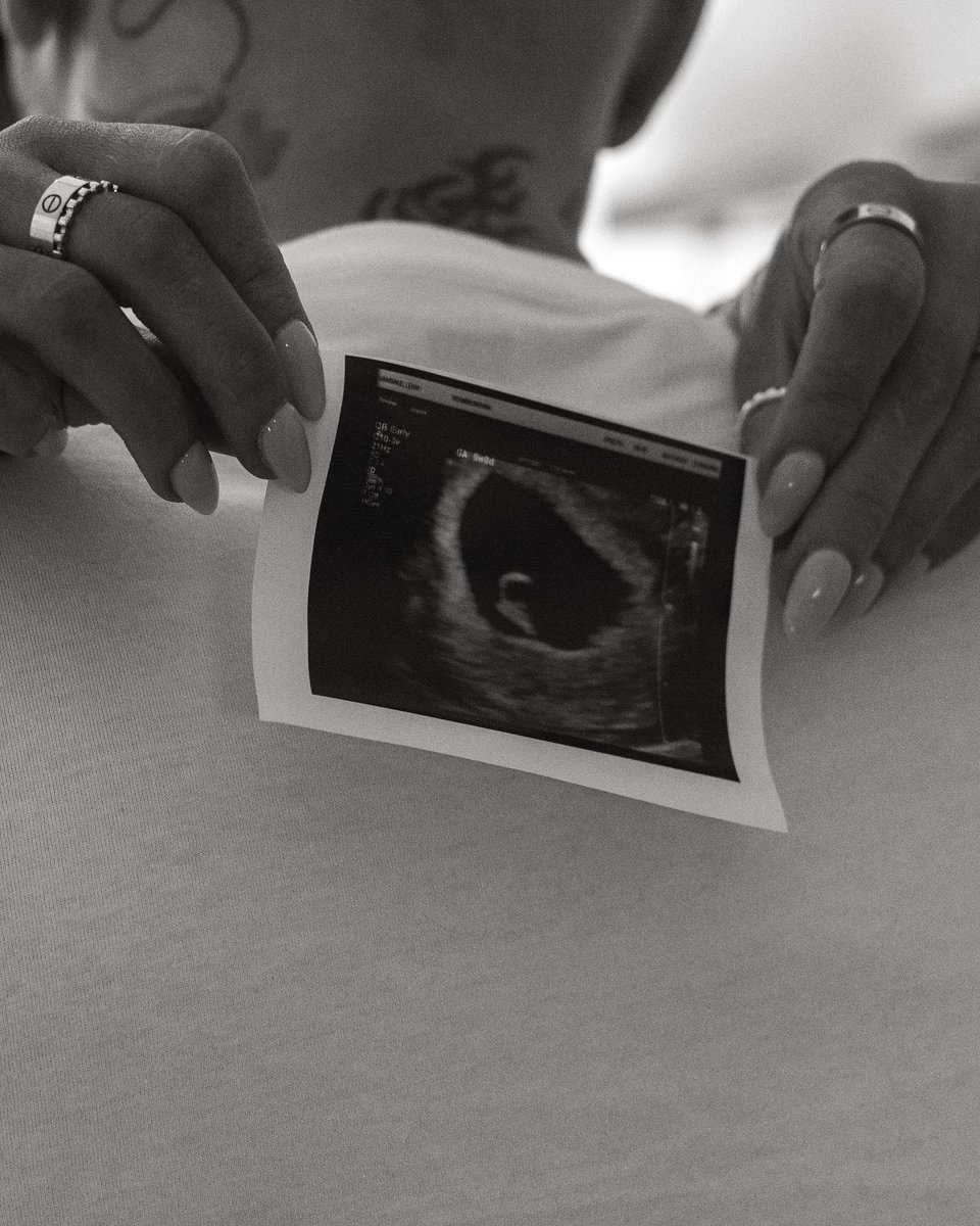 probabeswwe's tweet photo. Congrats Carmella &amp; Corey #WWERaw #SmackDown #WWENXT https://t.co/0CUUn5h8d3