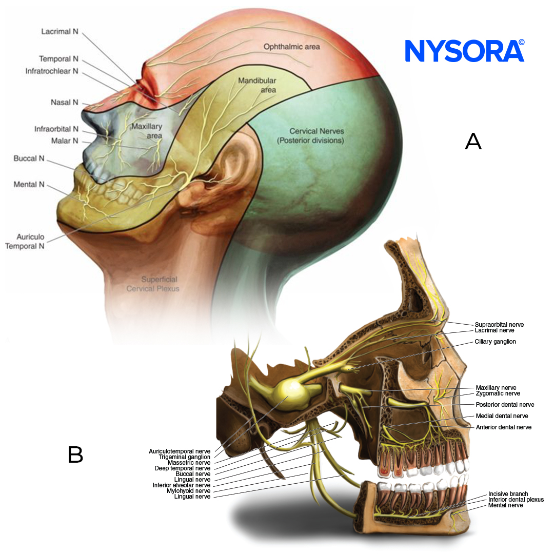 NYSORA's tweet image. From NYSORA&apos;s Compendium - here&apos;s a clinical pearl for the #Trigeminal Nerve!

The neural block of the trigeminal #ganglion is reserved for patients with trigeminal #neuralgia who do not respond to #pharmacologic therapy.

Subscribe here: bit.ly/3JuovCO