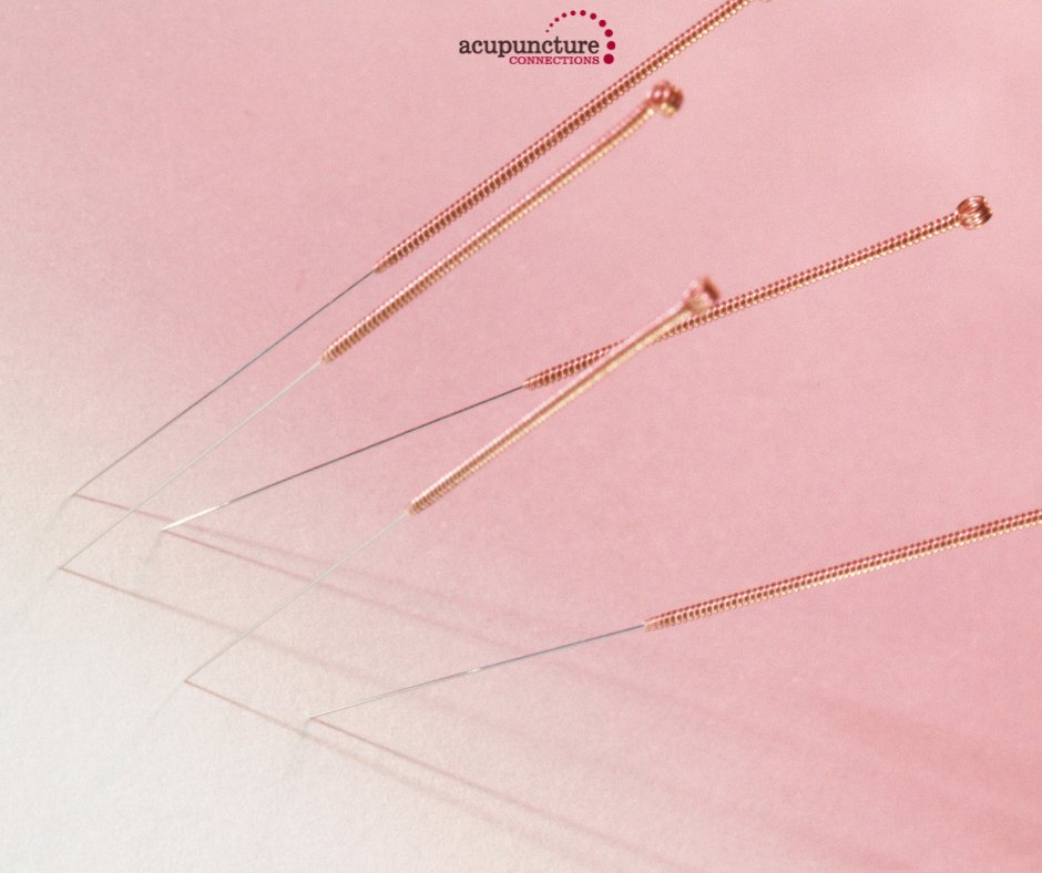 AcupConnections's tweet photo. Why do patients think acupuncture needles hurt? Did you know acupuncturists are highly skilled professionals who alleviate these fears through safe and clean needle techniques?
You'll be surprised; you won't feel the needles at ALL! 📷
#nopain #tinyneedles #healthandwellness https://t.co/0O1x79bxgc