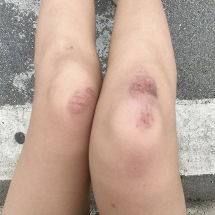 polo__cl's tweet photo. cause if you like the girls who always have scraped knees, BABY I'M PERFECT, BABY I'M PERFECT FOR YOU https://t.co/Fawq9ZqXjQ