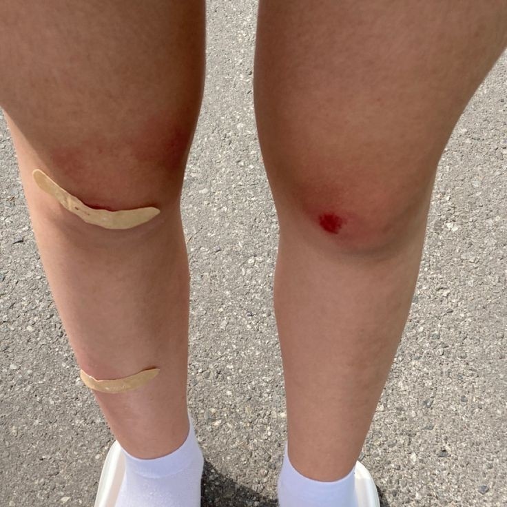 polo__cl's tweet photo. cause if you like the girls who always have scraped knees, BABY I'M PERFECT, BABY I'M PERFECT FOR YOU https://t.co/Fawq9ZqXjQ