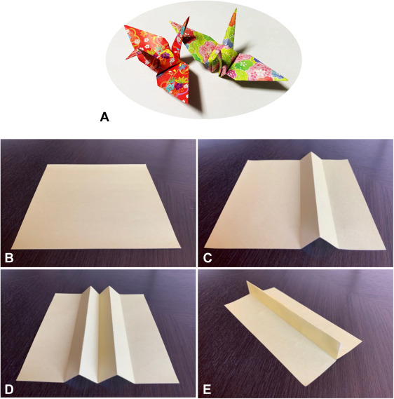 Masunaga et al present 'Modified double-layered suturing for a mucosal defect after colorectal endoscopic submucosal dissection (Origami method (with video).' giejournal.org/article/S0016-…