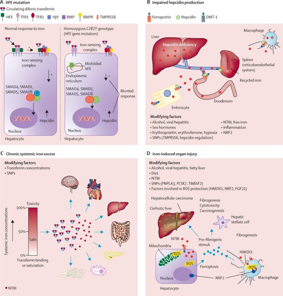 rabataller's tweet photo. This is a must read seminar on HEMOCHROMATOSIS in @TheLancet 

- Why the European ancestry
- Pathogenesis
- Current therapy and drugs in the pipeline

#livertwitter #MedTwitter 
https://t.co/nDy4Unrh7P https://t.co/Wbv7Oj2pfB