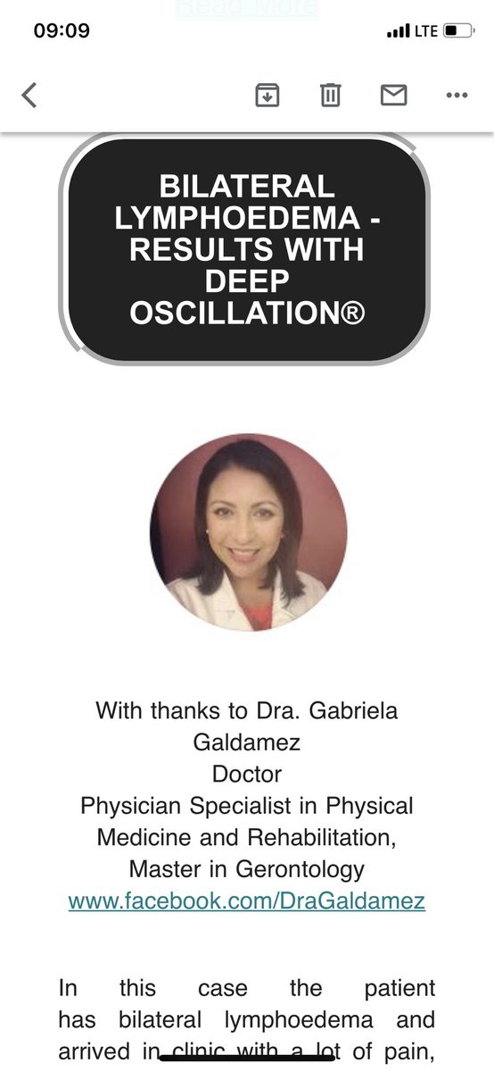 GaldamezDra's tweet photo. Thanks to @PhysioPod for mentioning my lymphoedema case in their monthly News letter!
So grateful and honoured! #deeposcillation #lymphoedema #rehabilitation #physiopod_uk https://t.co/6YVMZCqQMK
