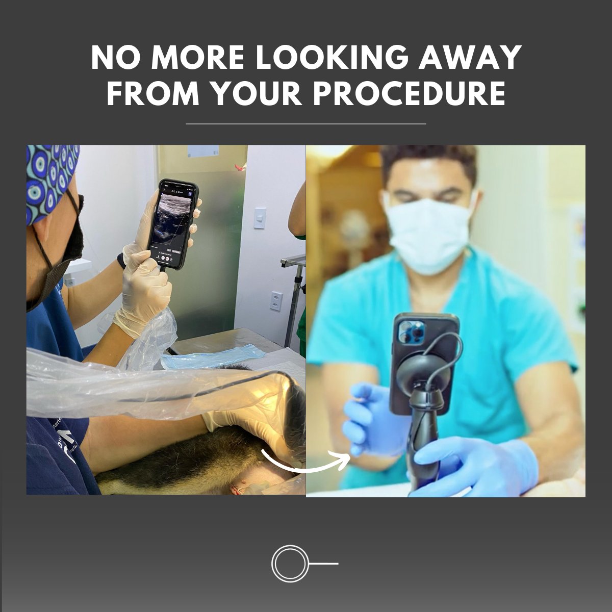 With the screen perfectly positioned right in front of you, there’s no need to turn your head or create a makeshift stand! Improve those ergonomics today when you pair OcuLine with <a href="/ButterflyNetInc/">Butterfly Network</a>

#ButterflyiQ #POCUS #oculine #ultrasoundguided #ultrasound #ultrasounddevice