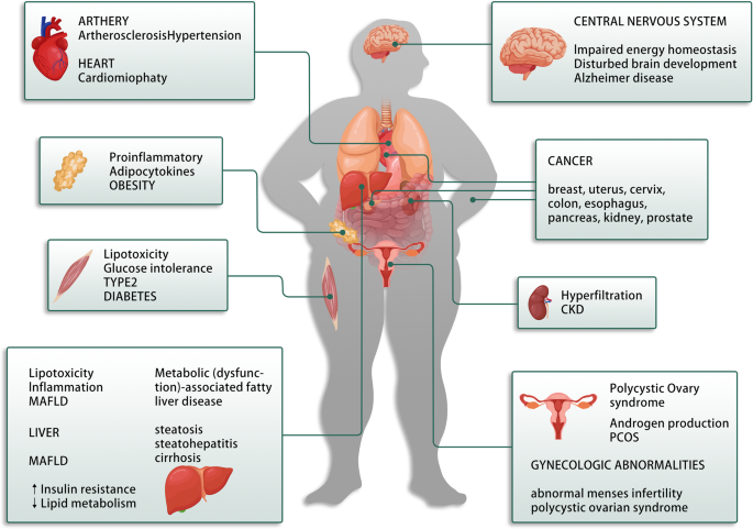 DrMijailTapia's tweet photo. La resistencia a la insulina es mucho más que progresión a diabetes, favorece condiciones como
🔹Obesidad
🔹Hipertensión
🔹Cardiomiopatía
🔹Alzheimer 
🔹ERC
🔹SOP
🔹Distintos tipos de cánceres 
🔹MAFLD- Fibrosis - Cirrosis 
🔹Ateroesclerosis https://t.co/7MbR6m1Cuy