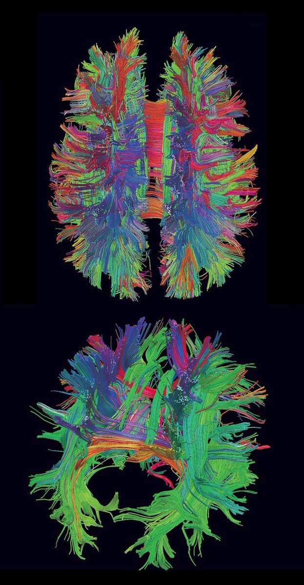 nimongii's tweet photo. @GuyNorcal Something psychedelic, but at the same time medical or scientific 👁️
It turns out that my training in medical school affects my creativity 😳 https://t.co/Xib1wWNJd9