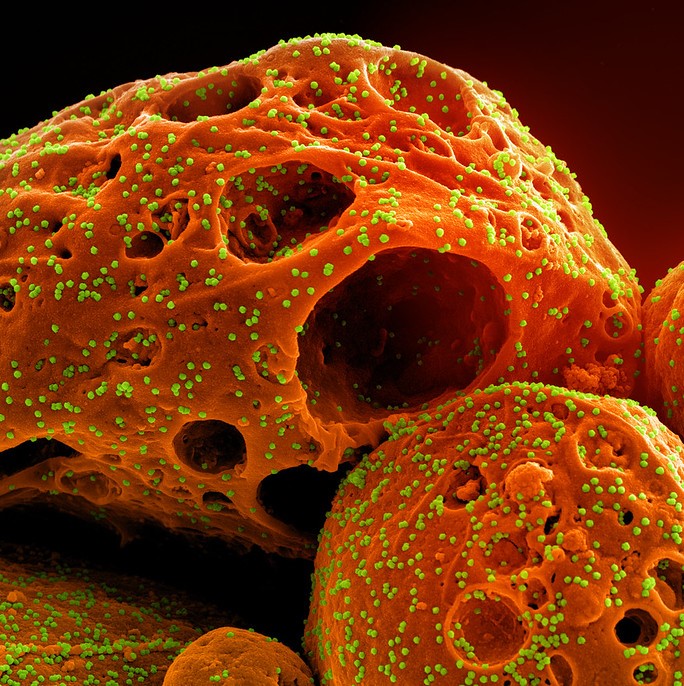 Christophe Veltsos on Twitter "RT CIDRAP Data show Omicron common