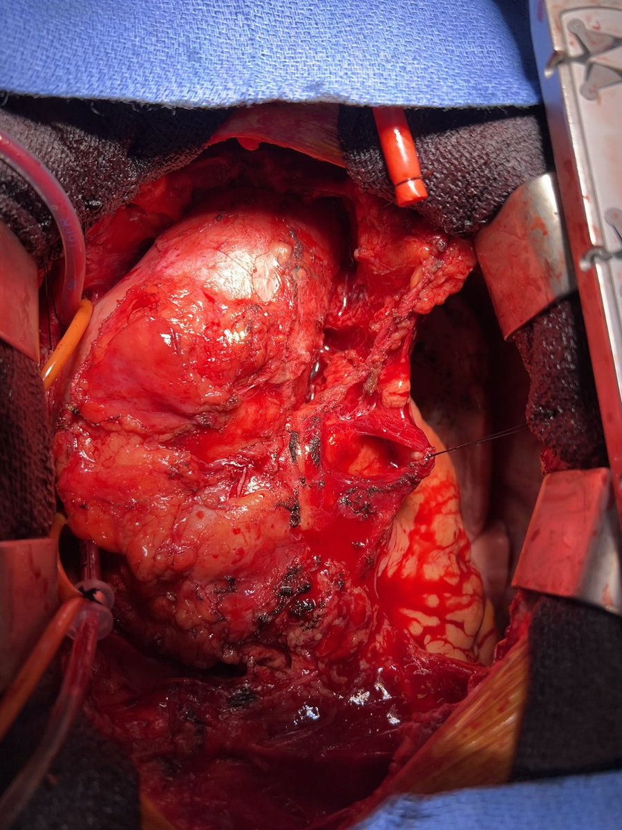 Stephen Spindel MD tweet media