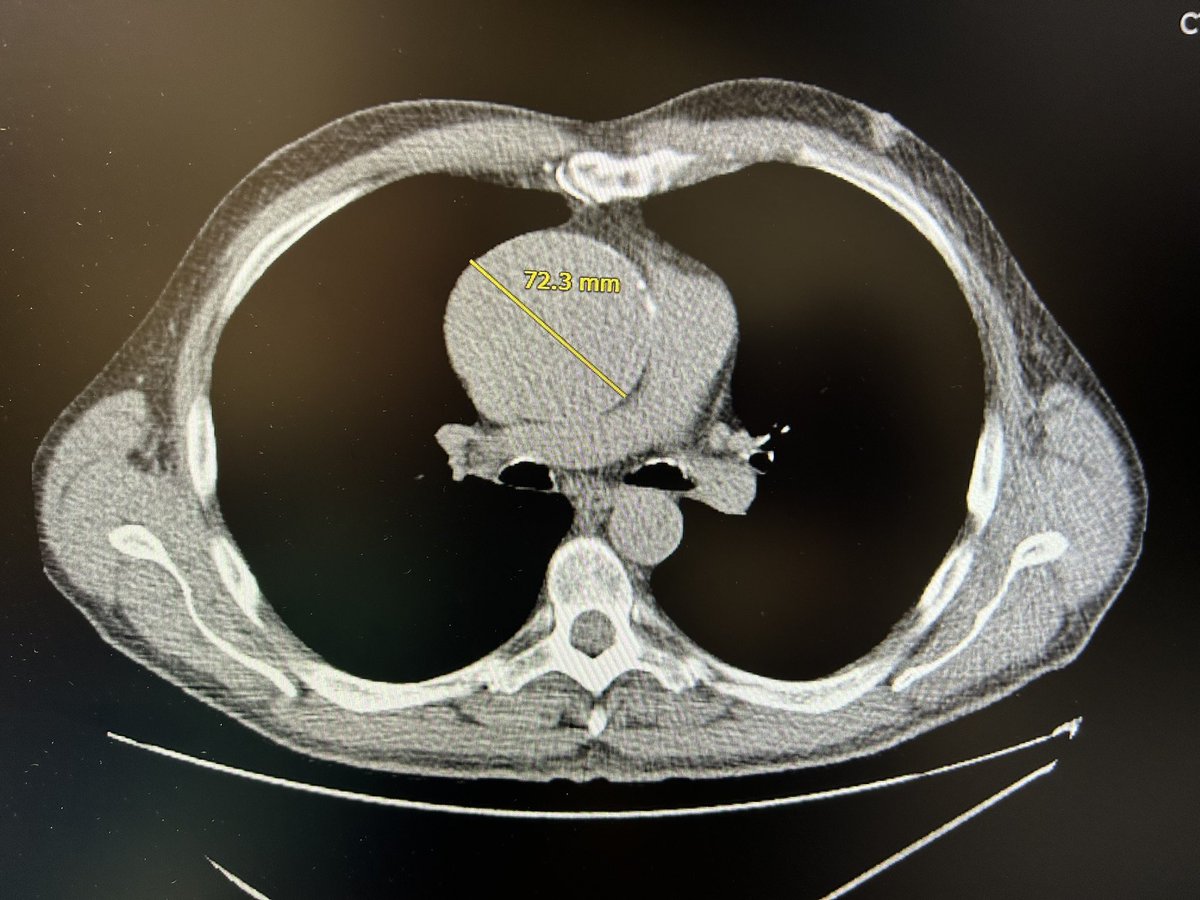 Stephen Spindel MD tweet media