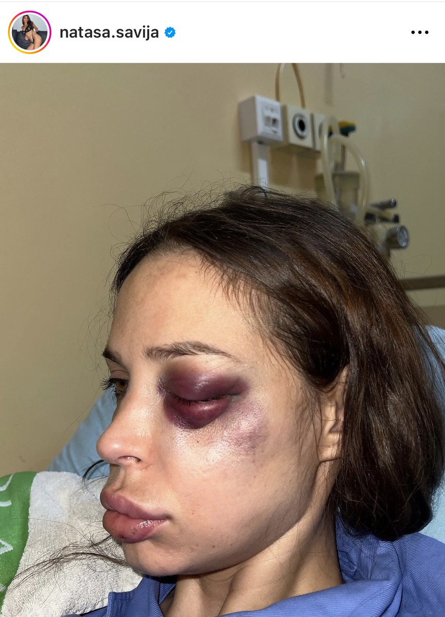 zoka5's tweet photo. Ne zanima me sta se drsilo, ko je izazvao, kako…zanima me samo da počinilac ovog DEMEK DELA bude sankcionisan i procesuiran! Ovo je jezivo https://t.co/GSDAENxc3x